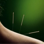 acupuncture green